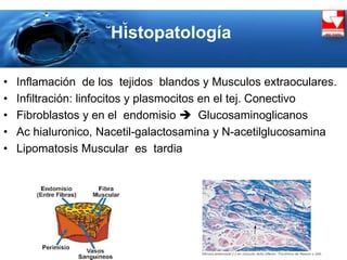 Histopatología
• Inflamación de los tejidos blandos y Musculos extraoculares.
• Infiltración: linfocitos y plasmocitos en el tej. Conectivo
• Fibroblastos y en el endomisio  Glucosaminoglicanos
• Ac hialuronico, Nacetil-galactosamina y N-acetilglucosamina
• Lipomatosis Muscular es tardia
 