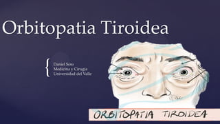 {
Orbitopatia Tiroidea
Daniel Soto
Medicina y Cirugía
Universidad del Valle
 