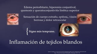 {Signo más temprano.
Inflamación de tejidos blandos
Edema periorbitario, hiperemia conjuntival,
quemosis y queratoconjuntivitis límbica superior
Sensación de cuerpo extraño, epifora,, visión
borrosa y dolor retroocular
Şahlı E, Gündüz K. Thyroid-associated Ophthalmopathy.Turk J Ophthalmol 2017;47:94-105
Ing E. Thyroid-Associated Orbitopathy. Medscape, 2016: 1 20
 