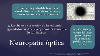  Resultado de la presión de los músculos
agrandados en el nervio óptico o los vasos que
lo suministran
Neuropatía óptica
Disminución gradual de la agudeza
visual, alteración de la visión del color y
escotomas centrales o paracentrales
FONDO DE OJO
edema del disco
óptico, pliegues
de la coroides,
palidez del disco
óptico
Şahlı E, Gündüz K. Thyroid-associated Ophthalmopathy.Turk J Ophthalmol 2017;47:94-105
Ing E. Thyroid-Associated Orbitopathy. Medscape, 2016: 1 20
 