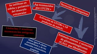 ŞahlıE,GündüzK.Thyroid-associatedOphthalmopathy.TurkJOphthalmol2017;47:94-105
IngE.Thyroid-AssociatedOrbitopathy.Medscape,2016:120
 