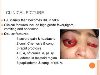 CLINICAL PICTURE
 U/L initially then becomes B/L in 50%
 Clinical features include high grade fever,rigors,
vomiting and headache
 Ocular features
1.severe pain & headache
2.conj. Chemosis & cong.
3.rapid proptosis
4.3, 4, 6th cranial n. palsy
5. edema in mastoid region
6.papilledema & cong. of ret. V.
 