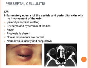PRESEPTAL CELLULITIS
C/F:
Inflammatory edema of the eyelids and periorbital skin with
no involvement of the orbit
 painful periorbital swelling
 Erythema and hyperemia of the lids
 Fever
 Proptosis is absent
 Ocular movements are normal
 Normal visual acuity and conjunctiva
 