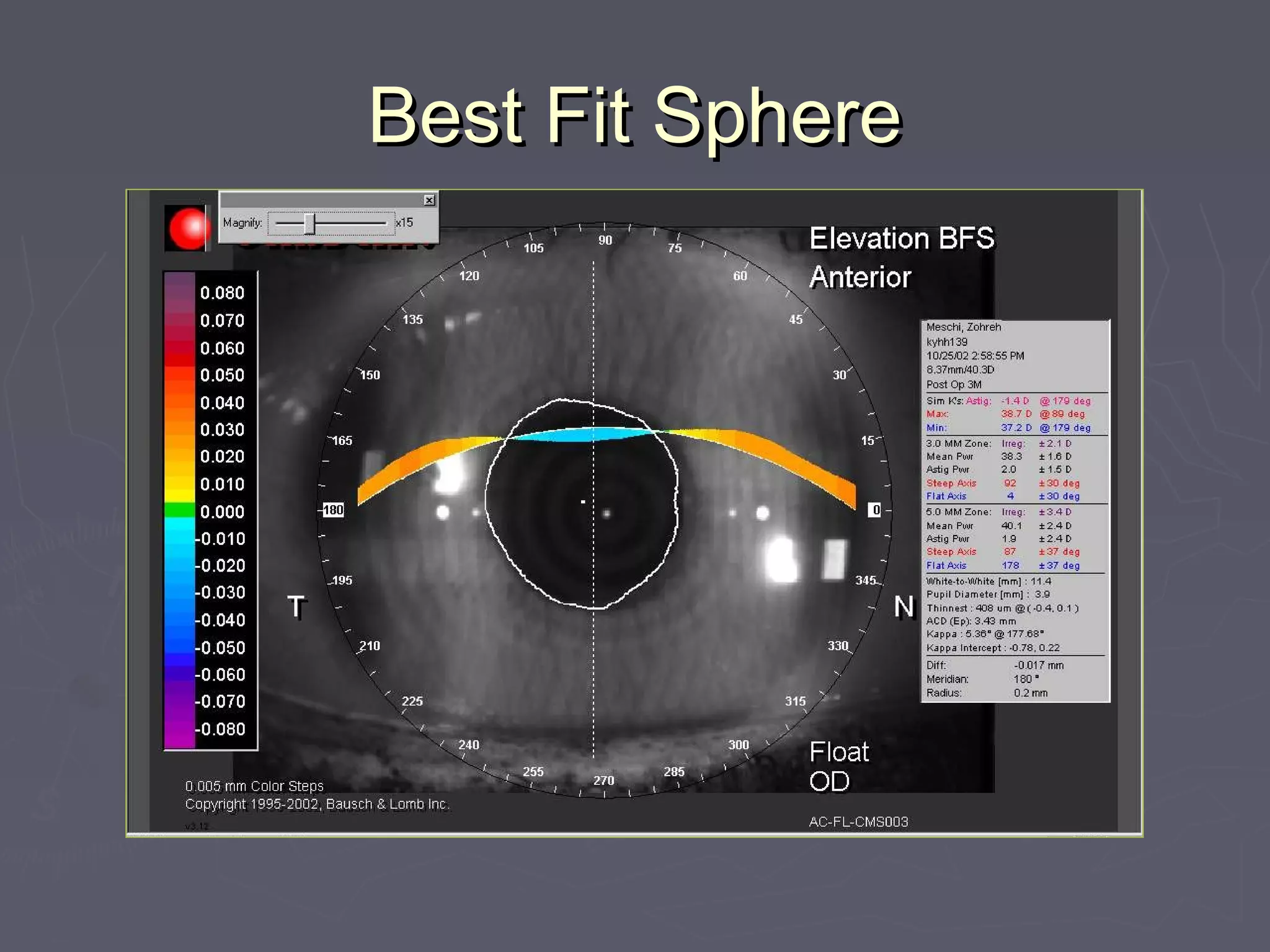 Best Fit SphereBest Fit Sphere
 