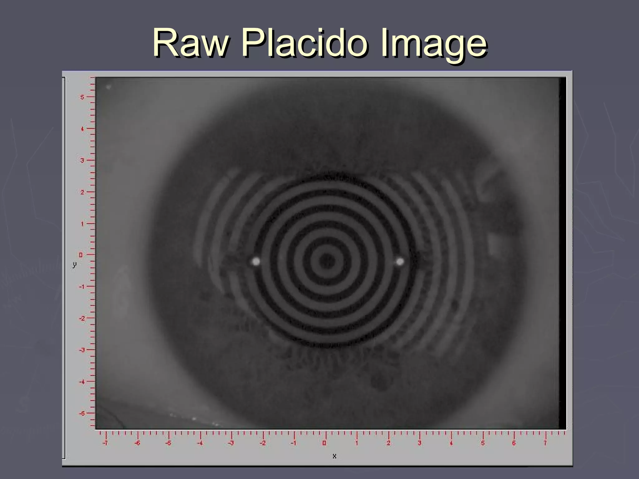 Raw Placido ImageRaw Placido Image
 