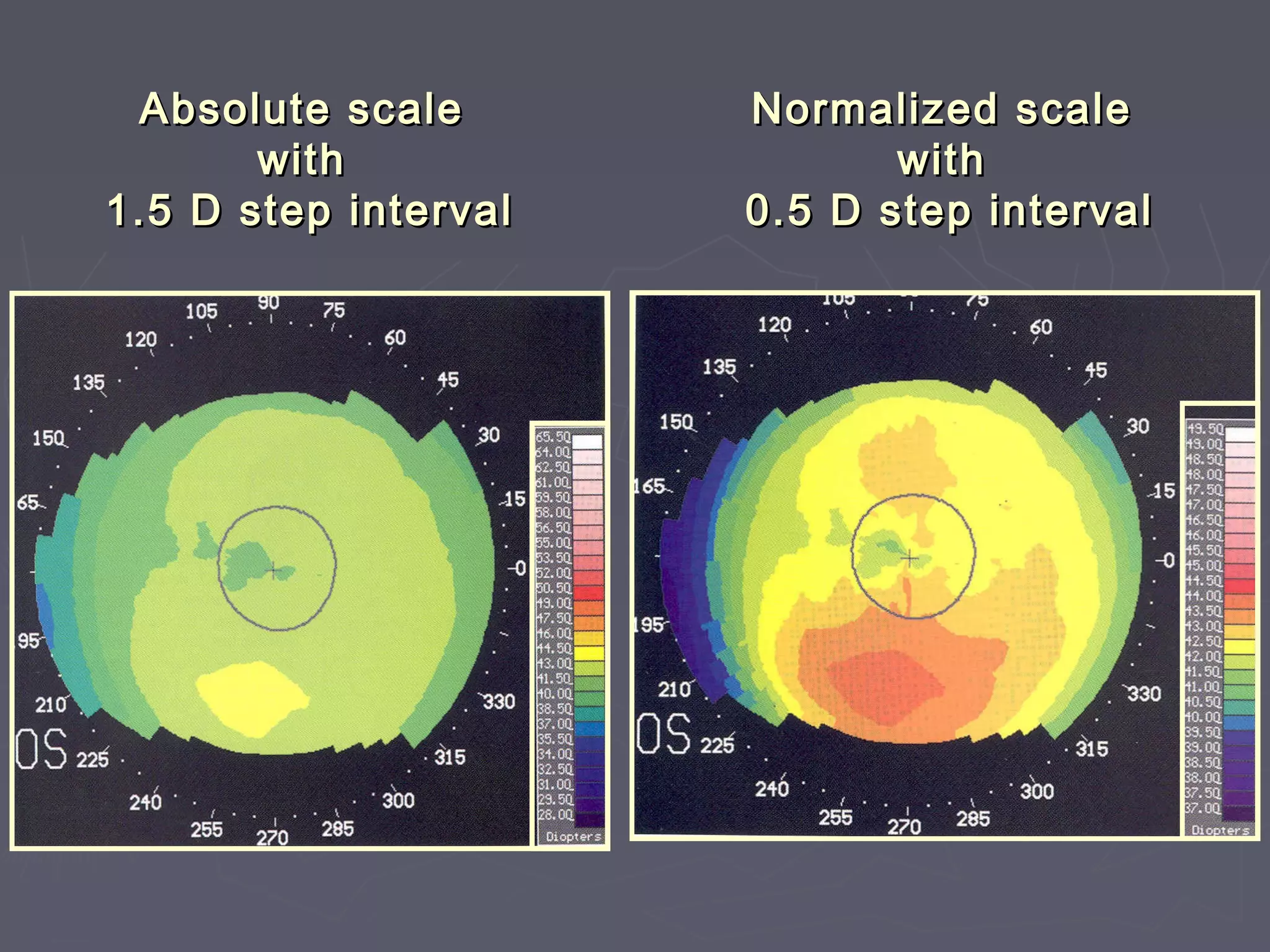 Absolute scaleAbsolute scale
withwith
1.5 D step interval1.5 D step interval
Normalized scaleNormalized scale
withwith
0.5 D step interval0.5 D step interval
 