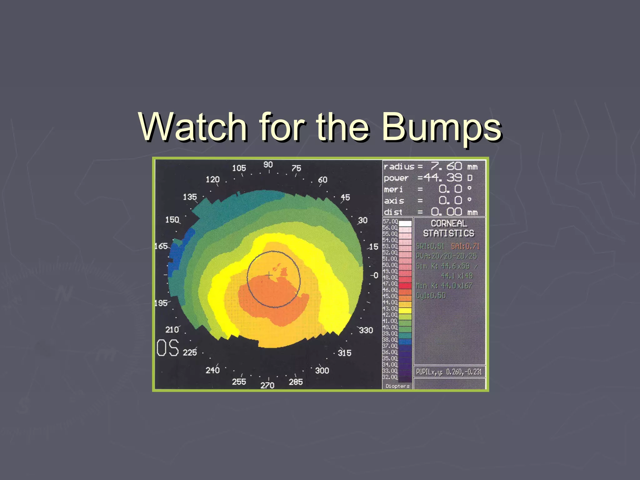 Watch for the BumpsWatch for the Bumps
 