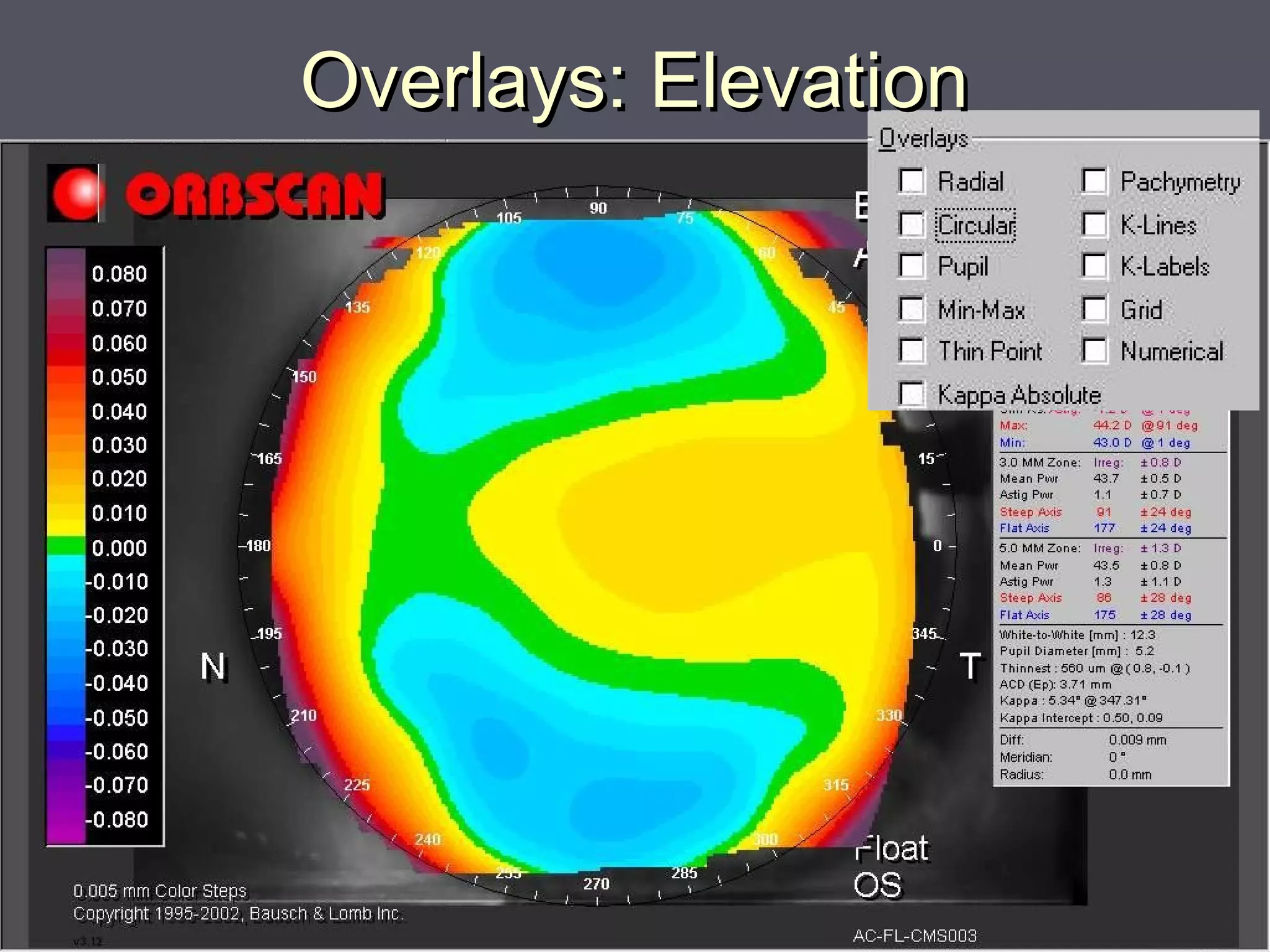Overlays: ElevationOverlays: Elevation
 