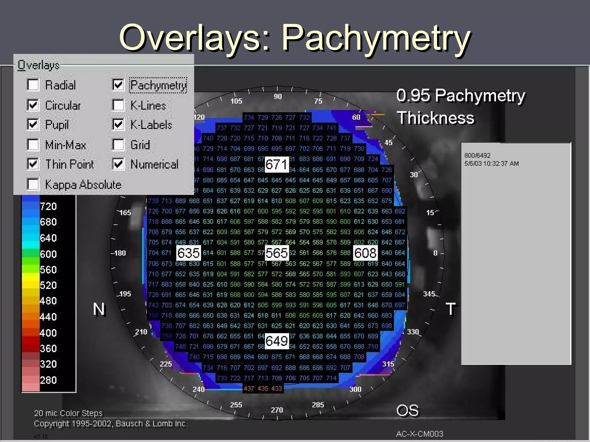 Overlays: PachymetryOverlays: Pachymetry
 