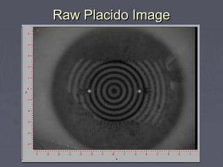 Raw Placido ImageRaw Placido Image
 