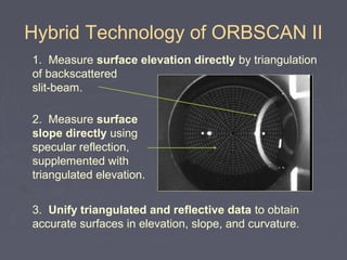 Hybrid Technology of ORBSCAN II
3. Unify triangulated and reflective data to obtain
accurate surfaces in elevation, slope, and curvature.
1. Measure surface elevation directly by triangulation
of backscattered
slit-beam.
2. Measure surface
slope directly using
specular reflection,
supplemented with
triangulated elevation.
 