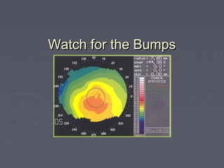 Watch for the BumpsWatch for the Bumps
 