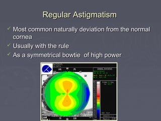 Regular AstigmatismRegular Astigmatism
 Most common naturally deviation from the normalMost common naturally deviation from the normal
corneacornea
 Usually with the ruleUsually with the rule
 As a symmetrical bowtie of high powerAs a symmetrical bowtie of high power
 
