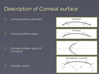 Description of Corneal surfaceDescription of Corneal surface
 Corneal surface elevationCorneal surface elevation
 Corneal surface slopeCorneal surface slope
 Corneal surface radius ofCorneal surface radius of
curvaturecurvature
 Corneal powerCorneal power
 