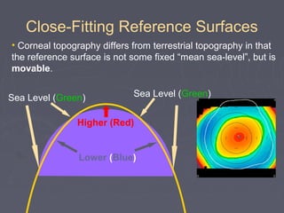 Close-Fitting Reference Surfaces
• Corneal topography differs from terrestrial topography in that
the reference surface is not some fixed “mean sea-level”, but is
movable.
Higher (Red)
Lower (Blue)
Sea Level (Green) Sea Level (Green)
 