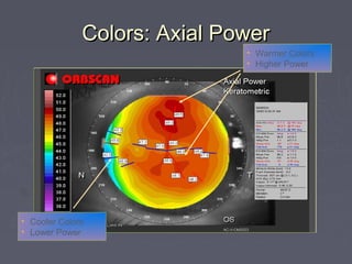 Colors: Axial PowerColors: Axial Power
• Warmer Colors
• Higher Power
• Cooler Colors
• Lower Power
 
