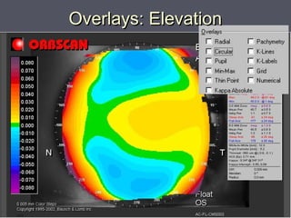 Overlays: ElevationOverlays: Elevation
 