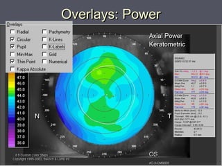 Overlays: PowerOverlays: Power
 