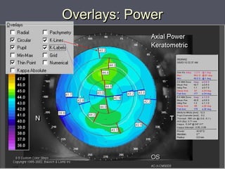 Overlays: PowerOverlays: Power
 