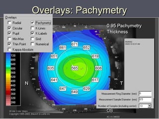 Overlays: PachymetryOverlays: Pachymetry
 