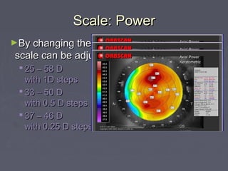 Scale: PowerScale: Power
►By changing the steps, the range of theBy changing the steps, the range of the
scale can be adjusted:scale can be adjusted:
 25 – 58 D25 – 58 D
with 1D stepswith 1D steps
 33 – 50 D33 – 50 D
with 0.5 D stepswith 0.5 D steps
 37 – 46 D37 – 46 D
with 0.25 D stepswith 0.25 D steps
 