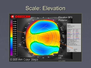 Scale: ElevationScale: Elevation
 