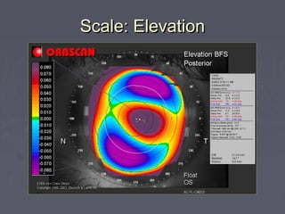 Scale: ElevationScale: Elevation
 