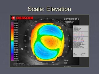 Scale: ElevationScale: Elevation
 