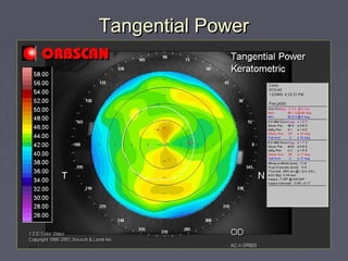 Tangential PowerTangential Power
 