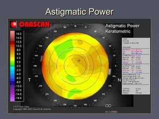 Astigmatic PowerAstigmatic Power
 