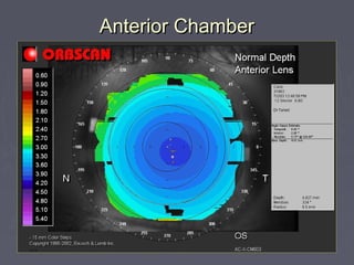 Anterior ChamberAnterior Chamber
 