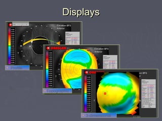 DisplaysDisplays
• Profile
• Topographic
• 3-dimensional
 