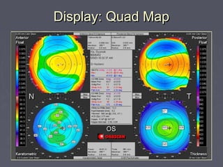 Display: Quad MapDisplay: Quad Map
 