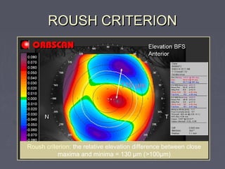 ROUSH CRITERIONROUSH CRITERION
Roush criterion: the relative elevation difference between close
maxima and minima = 130 µm (>100µm)
130 µm
 