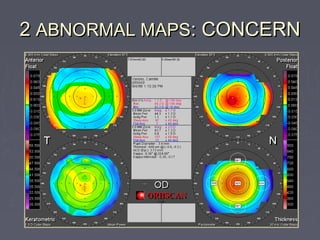 22 ABNORMAL MAPSABNORMAL MAPS: CONCERN: CONCERN
 