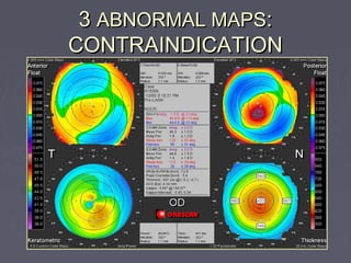33 ABNORMAL MAPSABNORMAL MAPS::
CONTRAINDICATIONCONTRAINDICATION
 