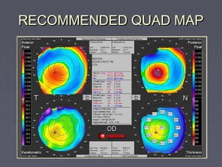 RECOMMENDED QUAD MAPRECOMMENDED QUAD MAP
 