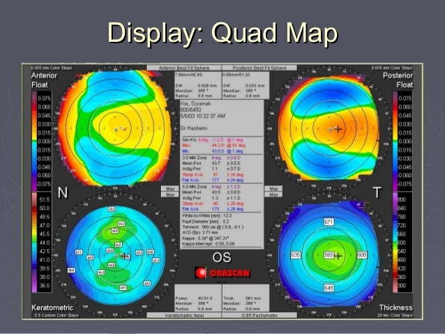 ORBSCAN INTERPRETATION EBOOK DOWNLOAD ORBSCAN INTERPRETATION EBOOK DOWNLOAD