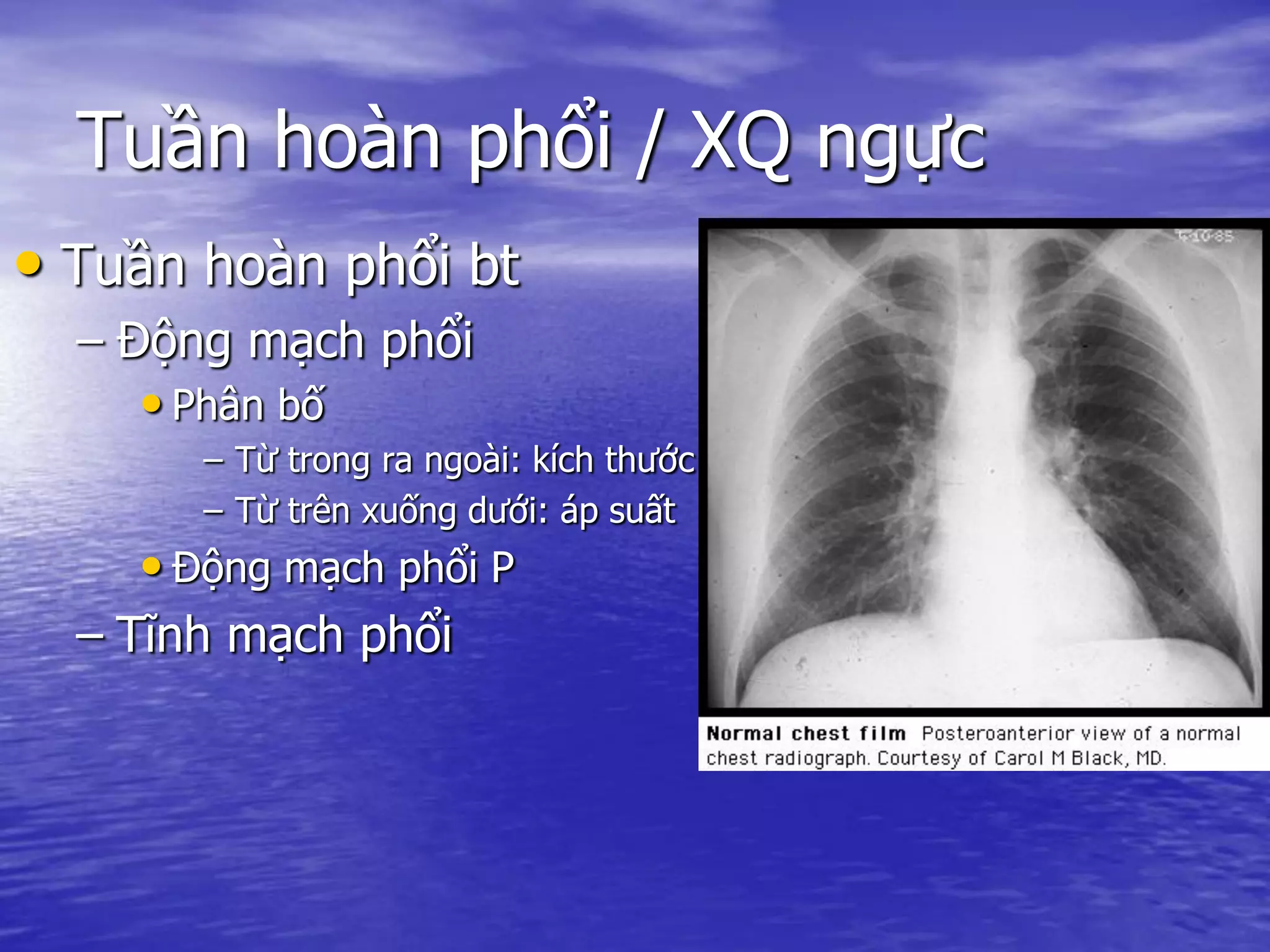 Tuần hoàn phổi / XQ ngực
• Tuần hoàn phổi bt
– Động mạch phổi
• Phân bố
– Từ trong ra ngoài: kích thước
– Từ trên xuống dưới: áp suất
• Động mạch phổi P
– Tĩnh mạch phổi
 
