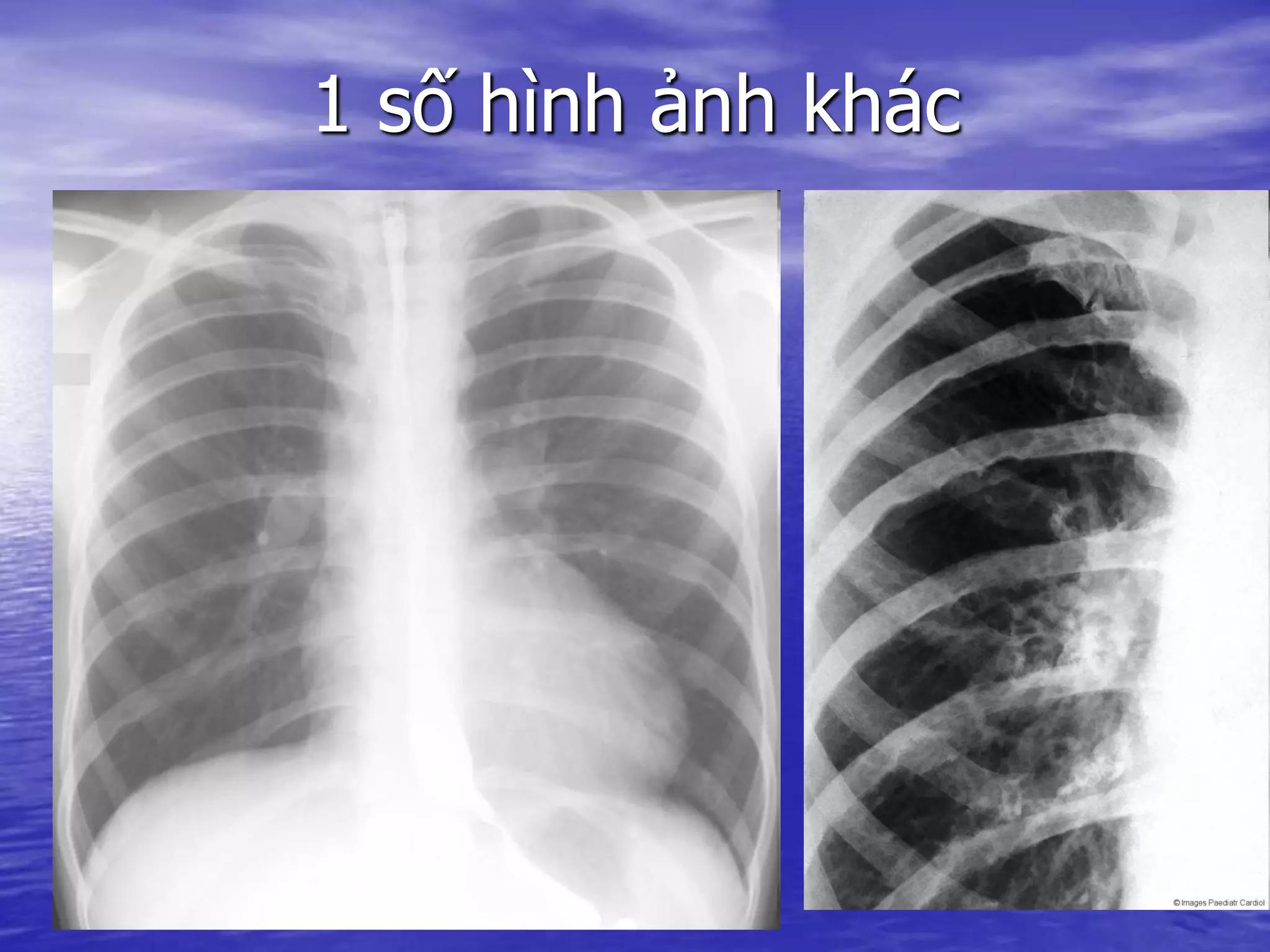 1 số hình ảnh khác
 