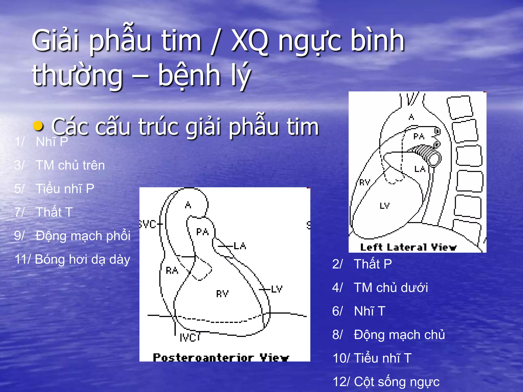 Giải phẫu tim / XQ ngực bình
thường – bệnh lý
• Các cấu trúc giải phẫu tim1/ Nhĩ P
3/ TM chủ trên
5/ Tiểu nhĩ P
7/ Thất T
9/ Động mạch phổi
11/ Bóng hơi dạ dày 2/ Thất P
4/ TM chủ dưới
6/ Nhĩ T
8/ Động mạch chủ
10/ Tiểu nhĩ T
12/ Cột sống ngực
 