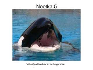 Nootka 5 Virtually all teeth worn to the gum line 