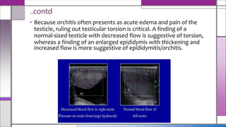• Because orchitis often presents as acute edema and pain of the
testicle, ruling out testicular torsion is critical. A finding of a
normal-sized testicle with decreased flow is suggestive of torsion,
whereas a finding of an enlarged epididymis with thickening and
increased flow is more suggestive of epididymitis/orchitis.
..contd
 