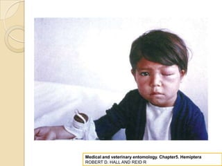 Medical and veterinary entomology. Chapter5. Hemiptera
ROBERT D. HALL AND REID R
 