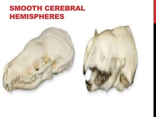 SMOOTH CEREBRAL
HEMISPHERES
 