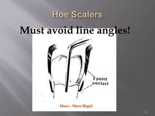 29Hoe ScalersMust avoid line angles!Hoes - More Rigid