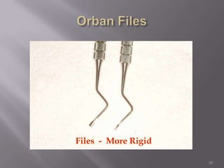 43Orban FilesFiles  -  More Rigid