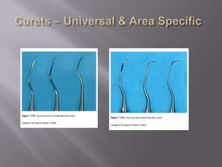 Curets – Universal & Area Specific