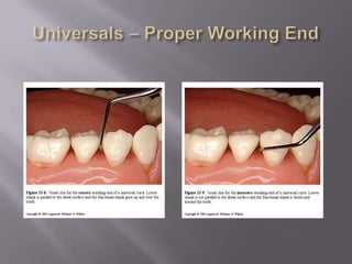 Maintain safe contact with complex root morphology