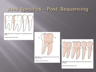 Curets – Area Specifics